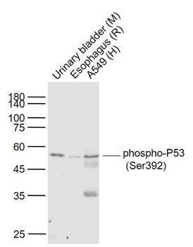P53 (phospho-Ser392) antibody