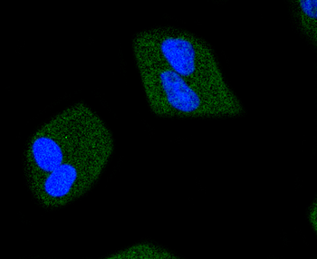 Phospho-JAK2 (Tyr1007+Tyr1008) Recombinant Rabbit Monoclonal Antibody