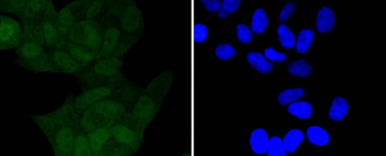 Phospho-IKB alpha (Ser32) Recombinant Rabbit Monoclonal Antibody