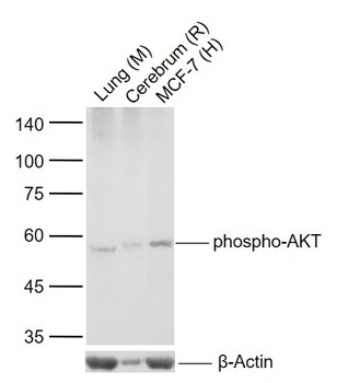AKT (phospho-Ser124) antibody