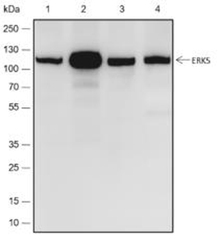ERK5 Recombinant Rabbit Monoclonal Antibody