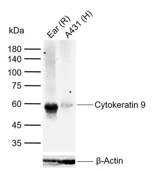Cytokeratin 9 antibody