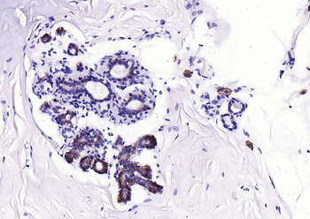 C-Kit Recombinant Rabbit Monoclonal Antibody