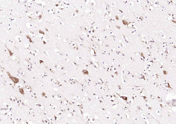RPS6 (N-term) Mouse Monoclonal Antibody