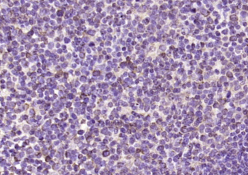 ENPP1 Rabbit Polyclonal Antibody
