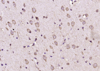 Glypican 6 Rabbit Polyclonal Antibody