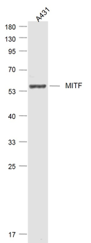 MITF Rabbit Polyclonal Antibody