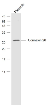 Connexin 26 Rabbit Polyclonal Antibody