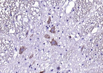 CX3CR1 Rabbit Polyclonal Antibody