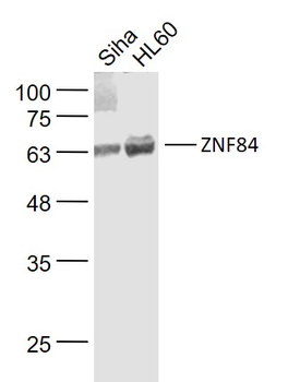 ZNF84 Rabbit Polyclonal Antibody