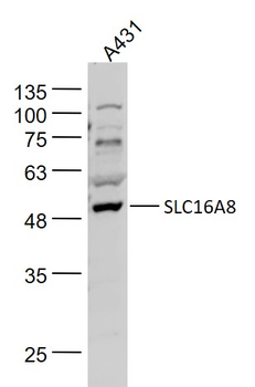 SLC16A8 Rabbit Polyclonal Antibody