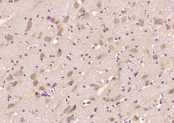 Artemin Rabbit Polyclonal Antibody