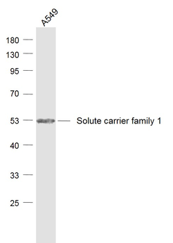 SLC1A5 Rabbit Polyclonal Antibody
