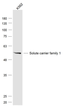 SLC1A5 Rabbit Polyclonal Antibody