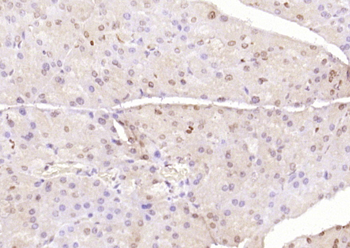 PTF1A Rabbit Polyclonal Antibody