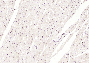 BNC1 Rabbit Polyclonal Antibody