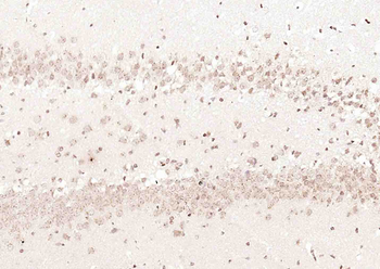 ErbB 4 Rabbit Polyclonal Antibody