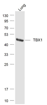 TBX1 Rabbit Polyclonal Antibody