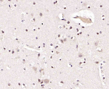 UBL7 Rabbit Polyclonal Antibody