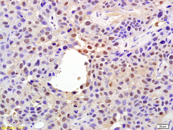 Phospho-YAP1 (Ser127) Rabbit Polyclonal Antibody