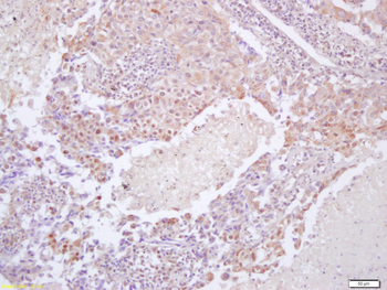 Phospho-eIF4EBP1 (Thr37 + Thr46) Rabbit Polyclonal Antibody