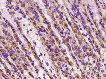 Phospho-ALOX5 (Ser271) Rabbit Polyclonal Antibody