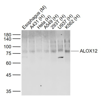ALOX12 Rabbit Polyclonal Antibody