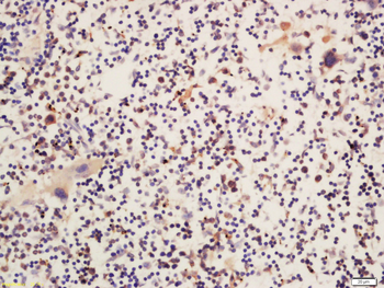 Phospho-Btk (Ser180) Rabbit Polyclonal Antibody