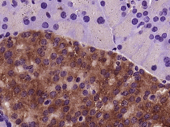 TCTP Rabbit Polyclonal Antibody