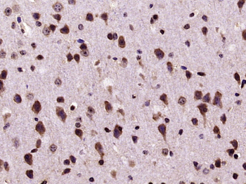 SMURF2 Rabbit Polyclonal Antibody