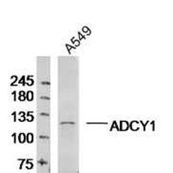 Adenylate cyclase 1 Rabbit Polyclonal Antibody