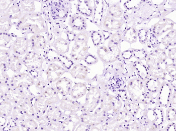 ADK Rabbit Polyclonal Antibody