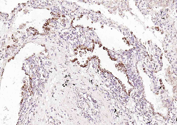 Phospho-ALK (Tyr1604) Rabbit Polyclonal Antibody