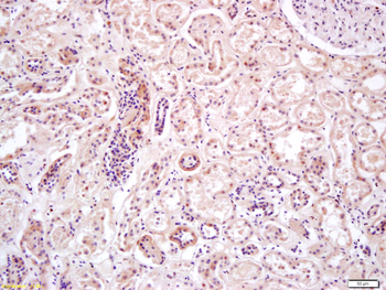 AMPK alpha 2 Rabbit Polyclonal Antibody
