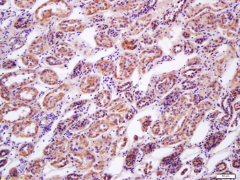 AMPK beta 2 Rabbit Polyclonal Antibody