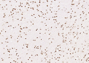 OGG1 Rabbit Polyclonal Antibody