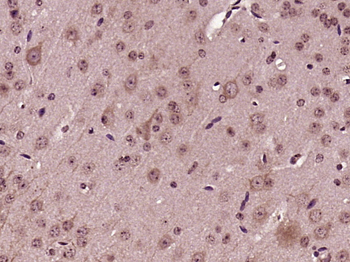 Apolipoprotein A V Rabbit Polyclonal Antibody