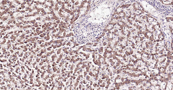 Apolipoprotein A V Rabbit Polyclonal Antibody