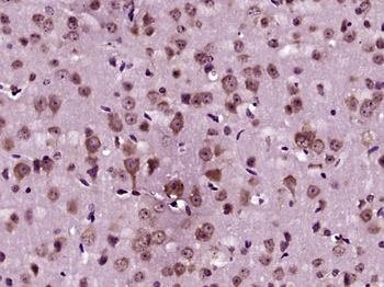 AANAT Rabbit Polyclonal Antibody