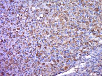 Perilipin A Rabbit Polyclonal Antibody