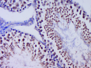 Phospho-AR/Androgen receptor (Ser597) Rabbit Polyclonal Antibody