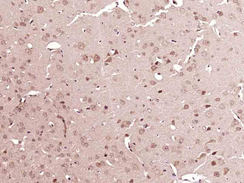 ATG4A Rabbit Polyclonal Antibody