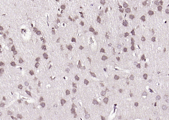 Phospho-BRAF (Ser365) Rabbit Polyclonal Antibody