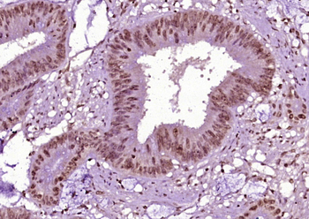 Phospho-Beta Catenin (Ser45) Rabbit Polyclonal Antibody
