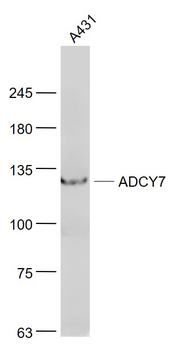 ADCY7 Rabbit Polyclonal Antibody