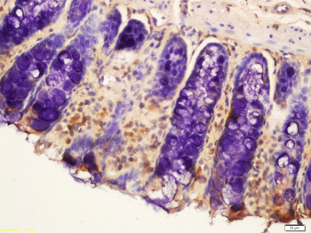ADCY8 Rabbit Polyclonal Antibody