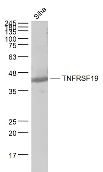 TNFRSF19 Rabbit Polyclonal Antibody