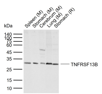 TNFRSF13B Rabbit Polyclonal Antibody