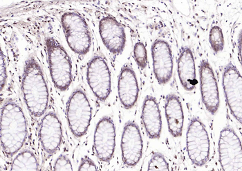 Phospho-cdc25A (Ser178) Rabbit Polyclonal Antibody