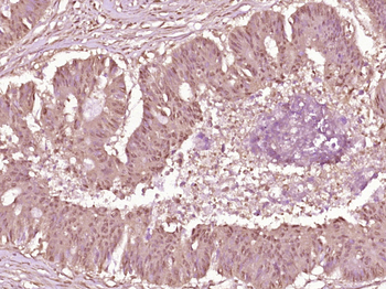 Phospho-cdc25A (Ser178) Rabbit Polyclonal Antibody